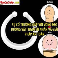su co thuong gap voi vong deo duong vat 22760d99