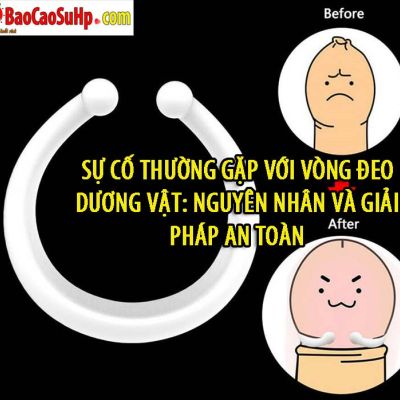 su co thuong gap voi vong deo duong vat f5c4f9a8