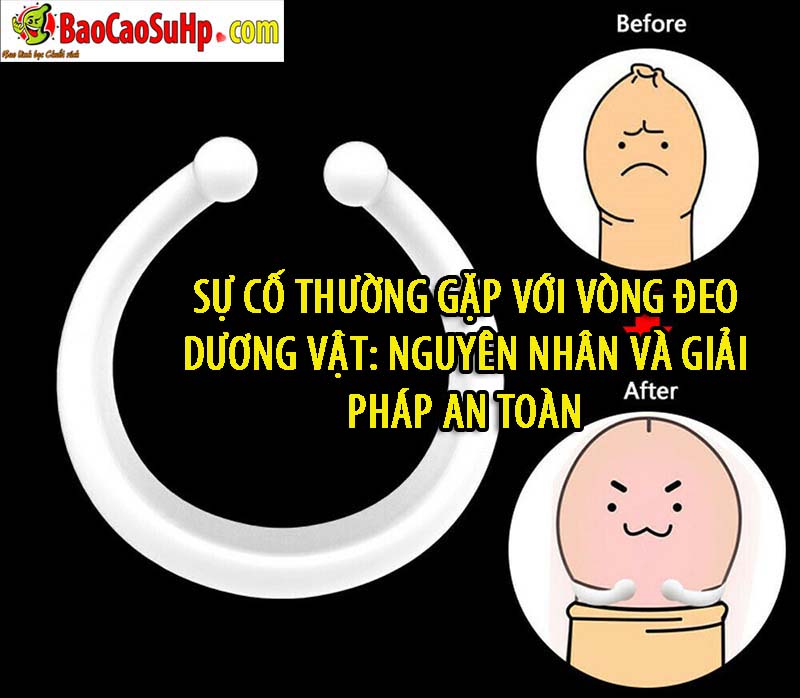 su co thuong gap voi vong deo duong vat su co thuong gap voi vong deo duong vat